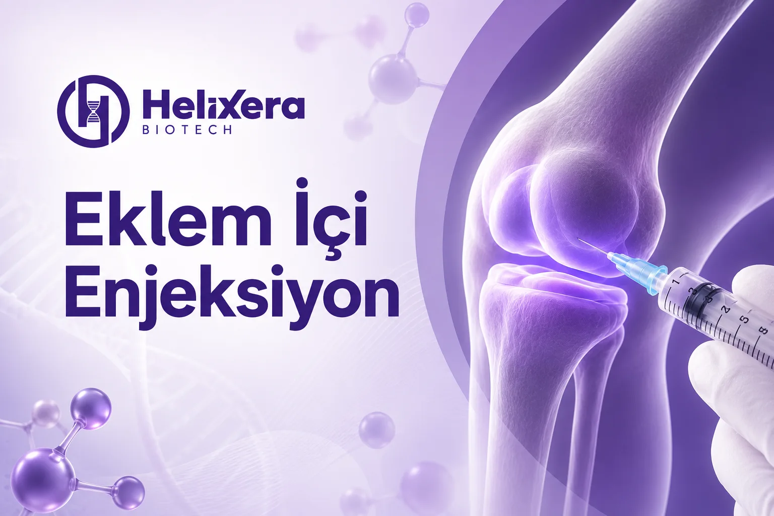 Eklem içi enjeksiyon uygulamasını temsil eden medikal görsel